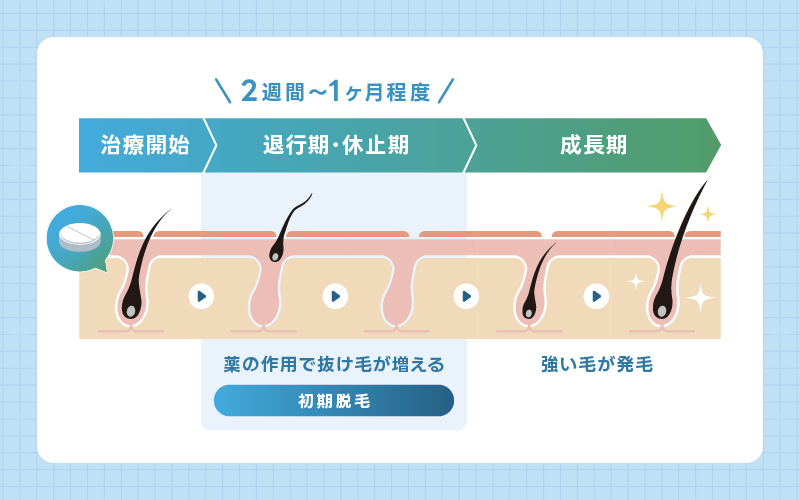 ミノキシジル 初期脱毛 イラスト